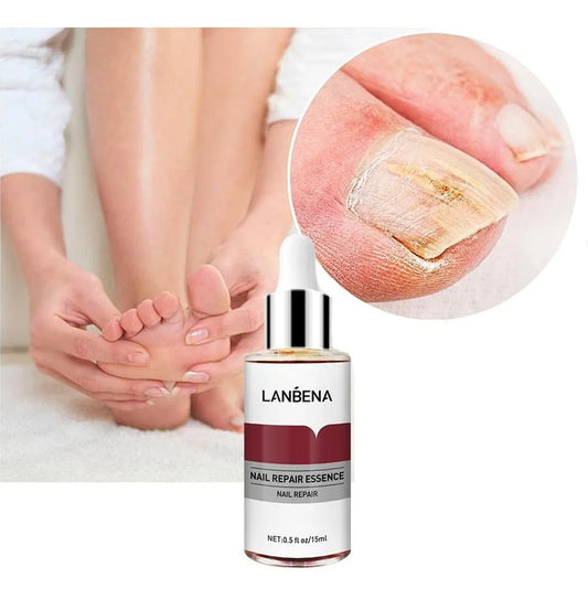 LANBENA TRATAMIENTO PREMIUM ANTIHONGOS