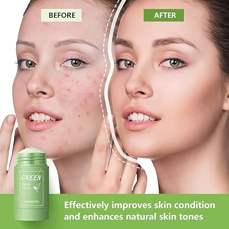 🌿 Green Mask Stick Detox Facial